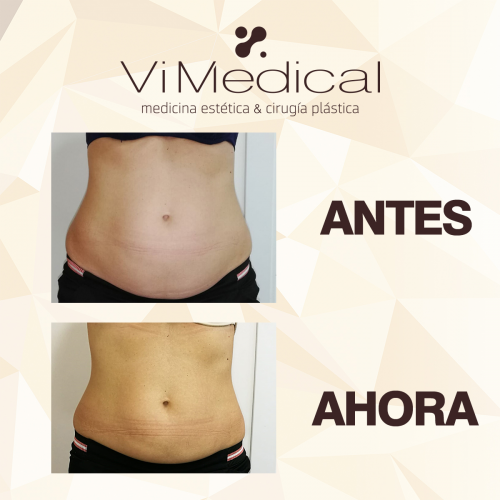 Tratamiento reductor